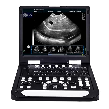 N60 Portable Veterinary Ultrasound Machine, PC-Based Ultrasound Systems, 15" High-Resolution LCD, for Dogs, Cats, and Small Animal Disease & Pregnancy Check (Micro-Convex Probe)